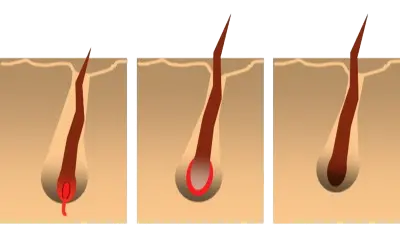 Hair growth